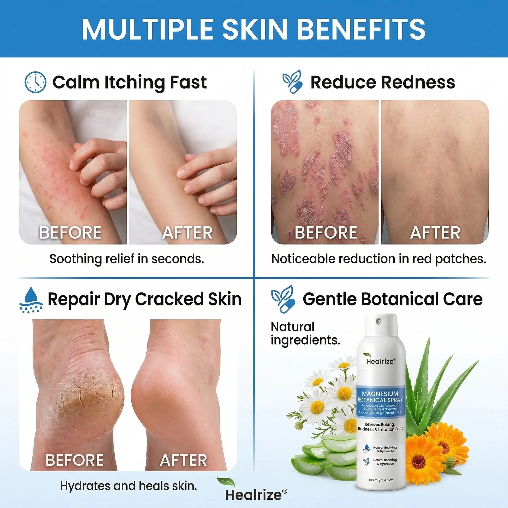 Magnesium Botanical Spray - Image 9