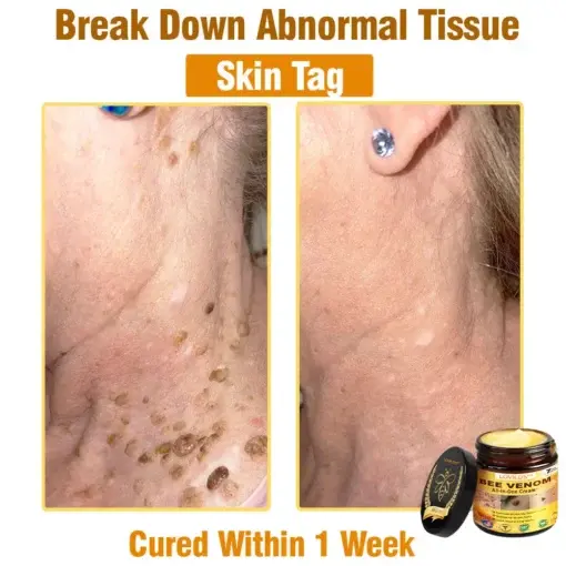 Bee Venom All-in-One Cream - Image 12