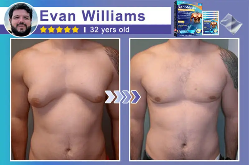 NanoMedix Gynecomastia Chest Fatburn & Firm Patch - Image 2
