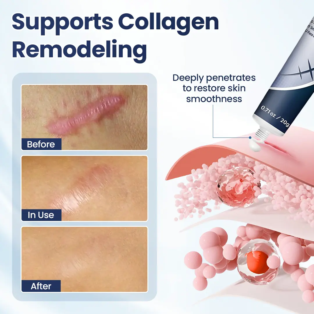 DermaFix Texture Repair Gel - Image 7