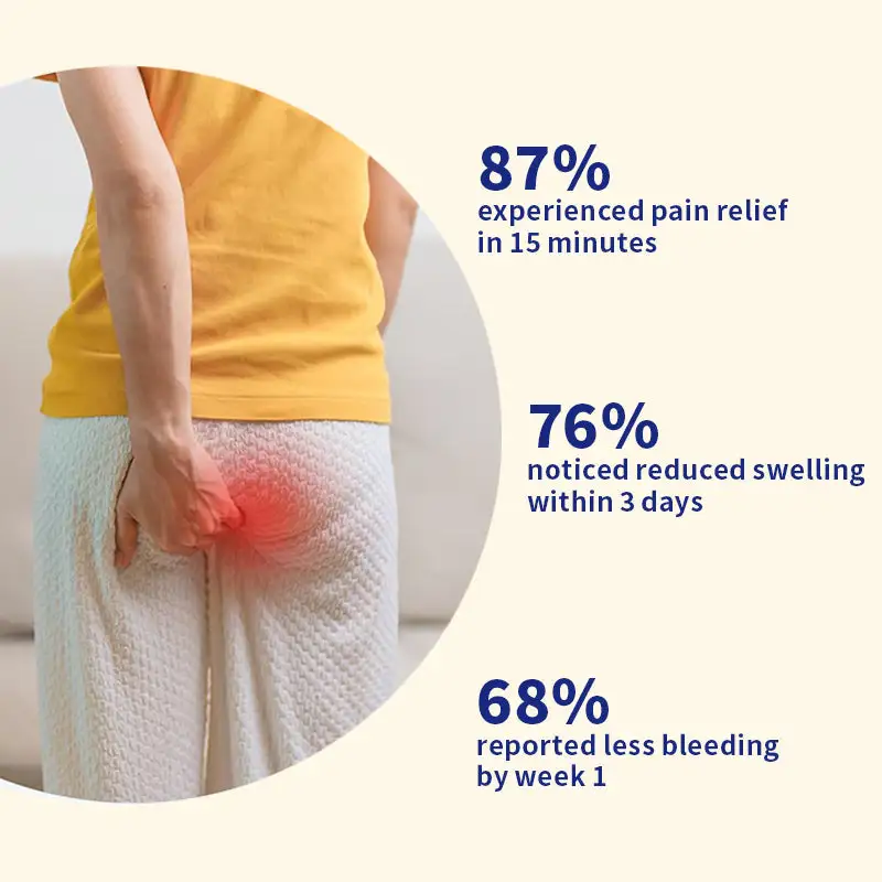 Hemorrhoid Cream – Fast Relief from Pain - Itching & Swelling - Image 3