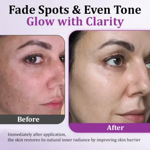 MelantraX Advanced Anti-Hyperpigmentation Essence - Image 6