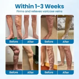 Alternative view of VeinGuard Herbal Spray