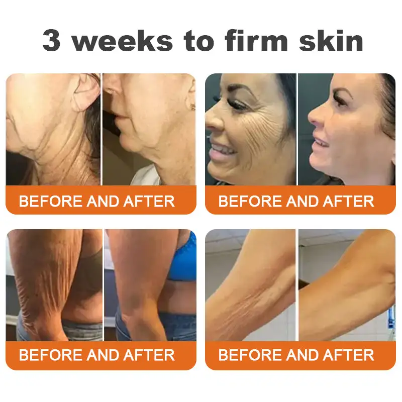 Winter Sale Botox Bee Venom Firming Serum Stick - Image 4