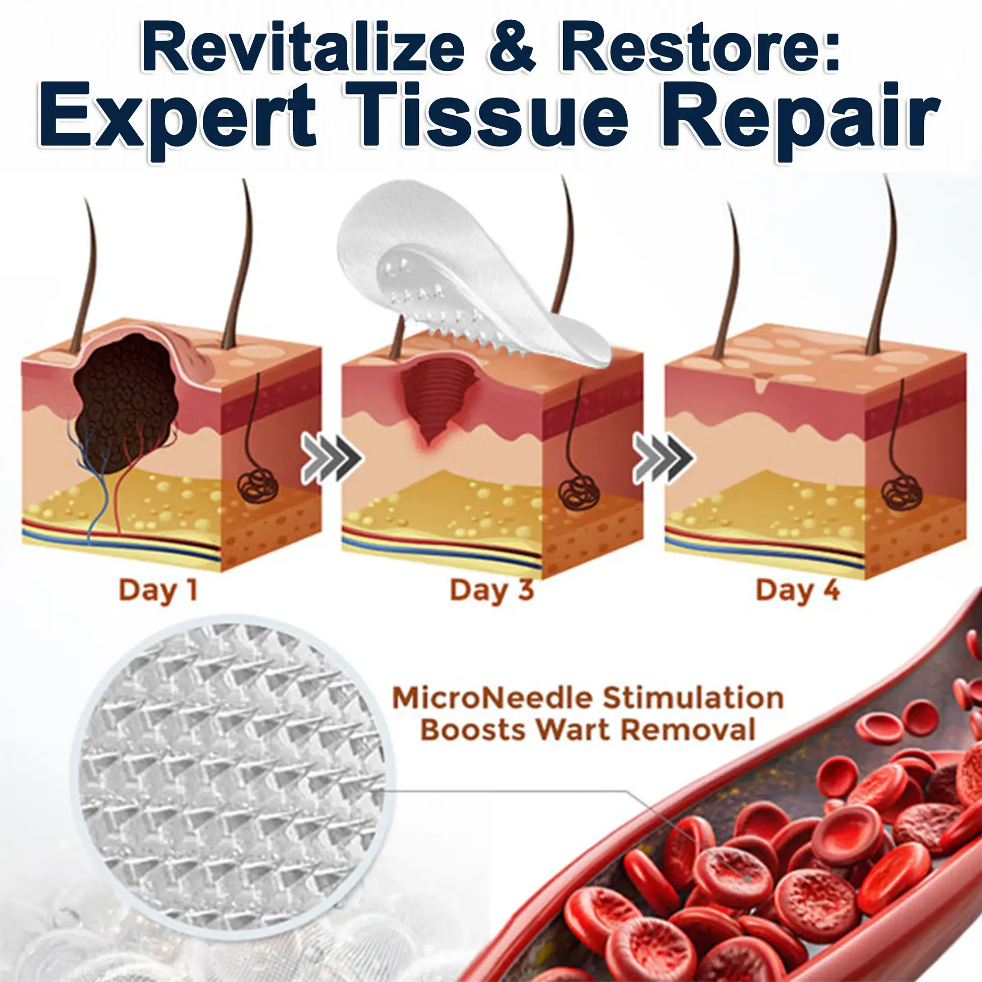2-in-1 Microneedle & Hydrocolloid Patch - Image 8