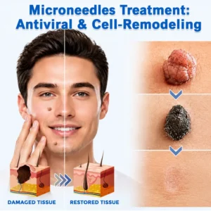 Alternative view of 2-in-1 Microneedle & Hydrocolloid Patch