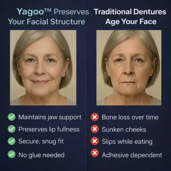 Newly upgraded second-generation complete dentures - Image 7