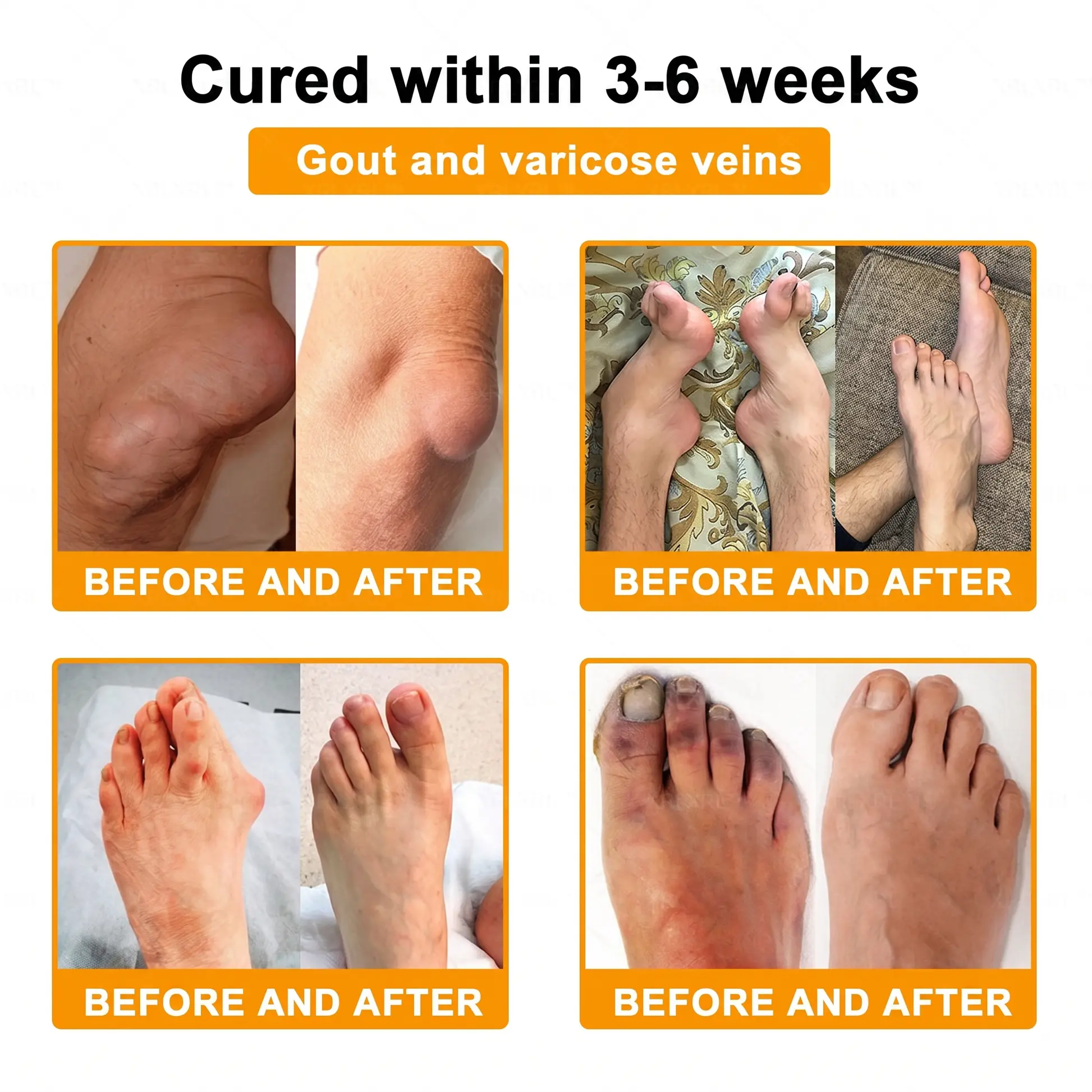 Bee Venom Pain-Relief Bone Healing Cream - Image 2