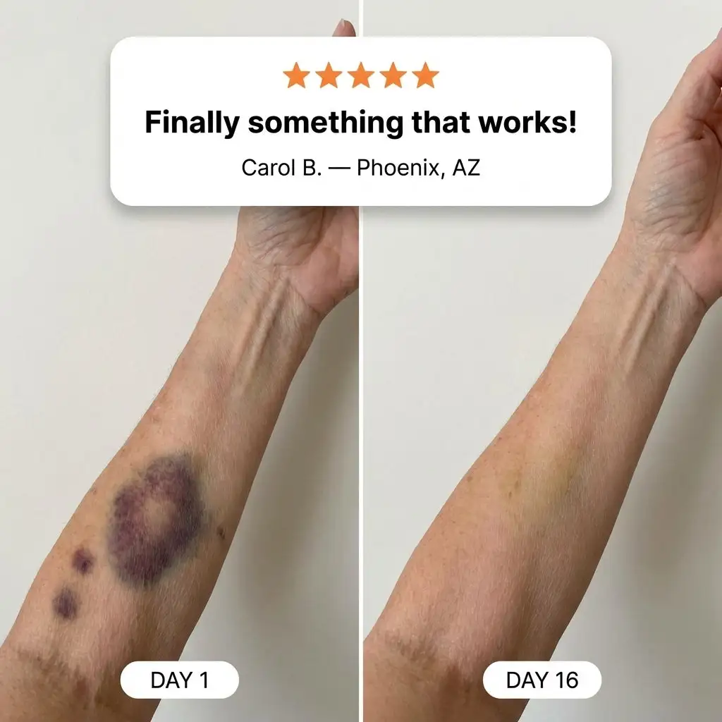 Bruise Repair & Skin-Strengthening Cream - Image 3