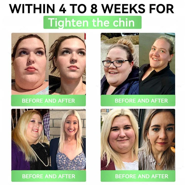 Moringa × Berberine × AMPK 8-Benefit Slimming & Metabolic Nano Microneedle Patch - Image 3
