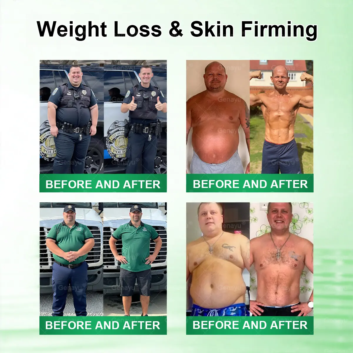 Moringa × Berberine × AMPK 8-Benefit Slimming & Metabolic Nano Microneedle Patch - Image 6