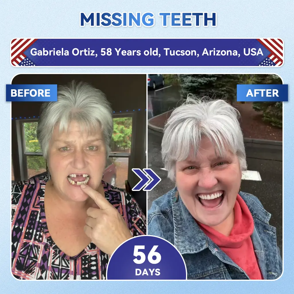 Tideglusib Fast‑Dissolving Tooth & Gum Repair Oral Strips - Image 5