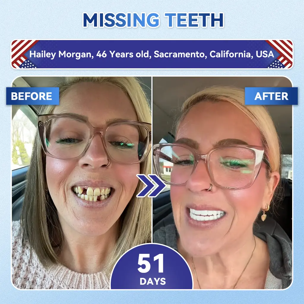 Tideglusib Fast‑Dissolving Tooth & Gum Repair Oral Strips - Image 6