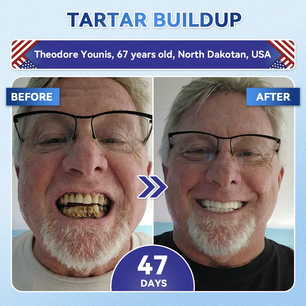 Tideglusib Fast‑Dissolving Tooth & Gum Repair Oral Strips - Image 7