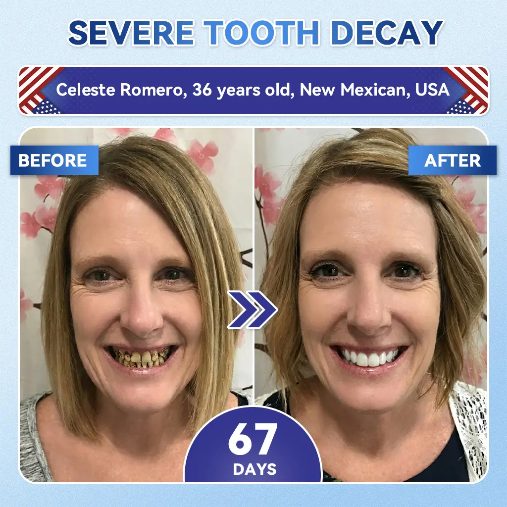 Tideglusib Fast‑Dissolving Tooth & Gum Repair Oral Strips - Image 8