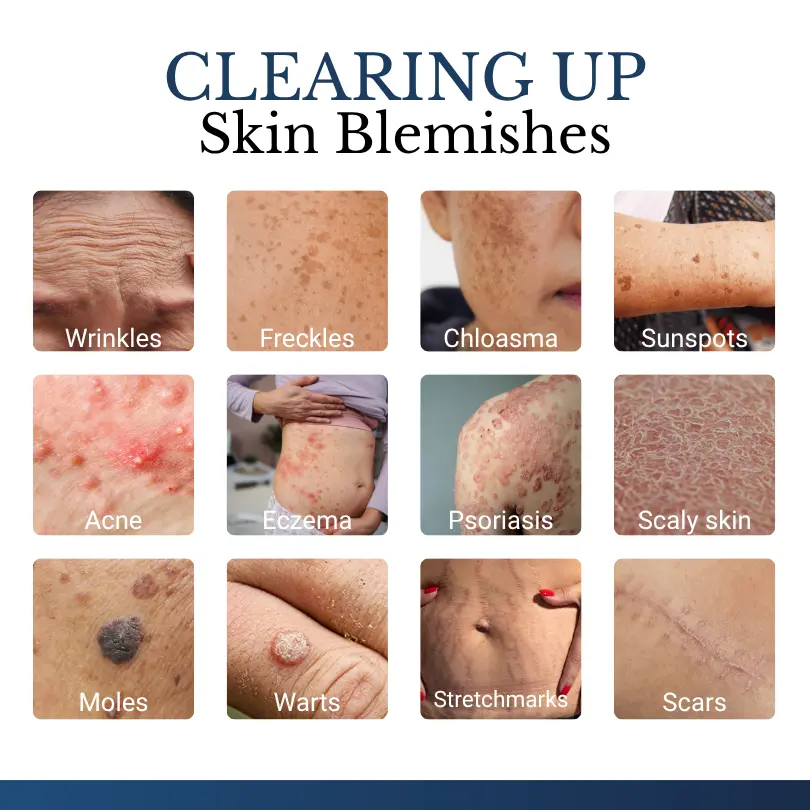DermFixPro 2-in-1 Microneedle & Hydrocolloid Patch - Image 3