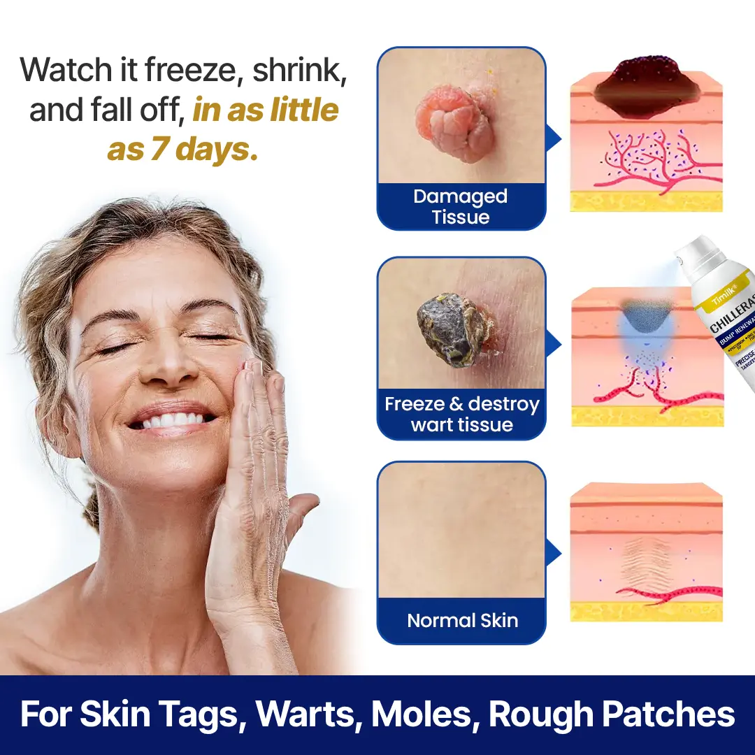 Bump Renewal Spray - Image 8