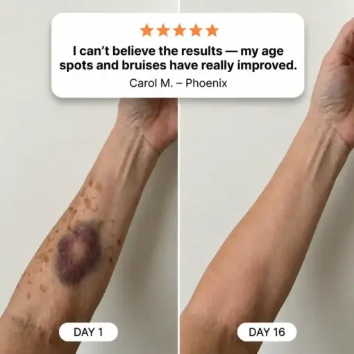 The Soft Dark Spot & Bruise Repair Cream - Image 2