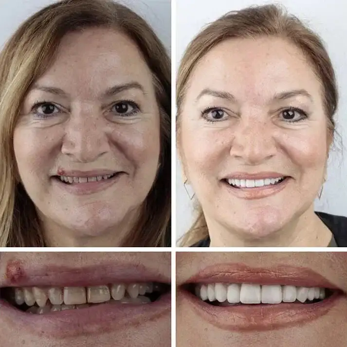 Natural Smile Upgrade - Image 12