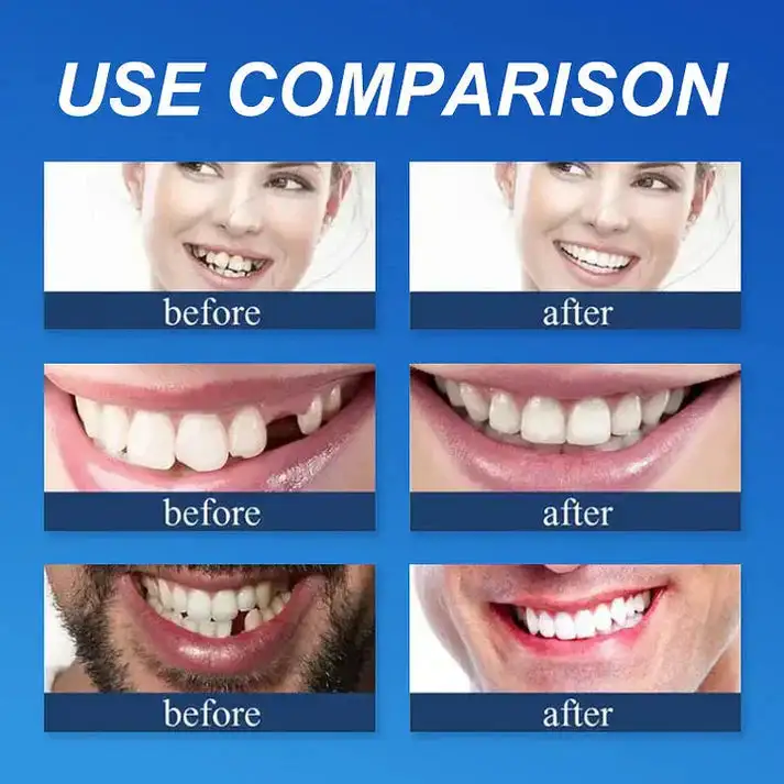 Natural Smile Upgrade - Image 9