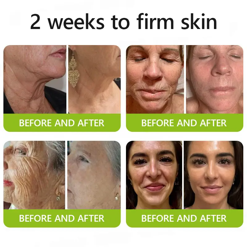 Botox & Retinol Shot - Image 4