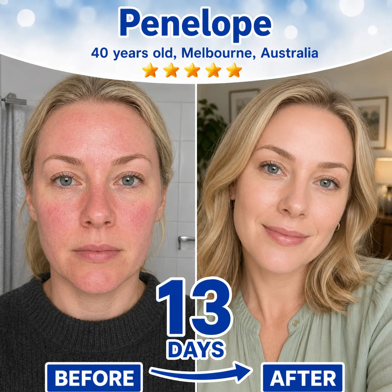 Skin Renewal Duo - Image 4