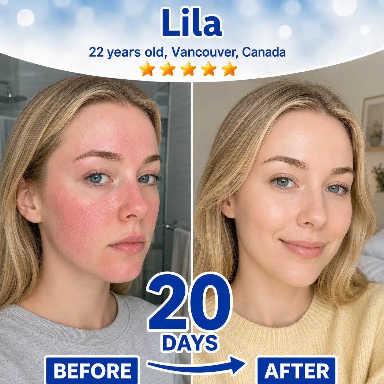 Skin Renewal Duo - Image 5