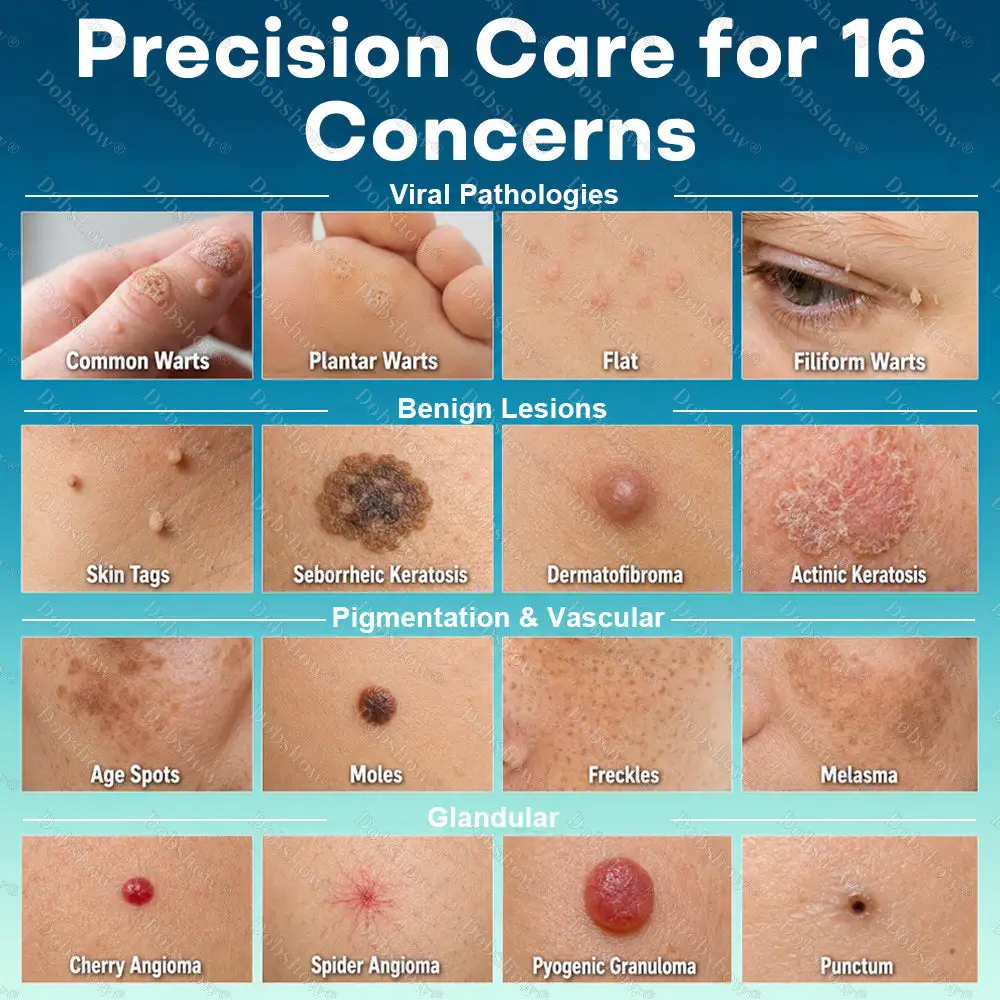 Precision Wart & Blemish Care Roll-On Pen - Image 2
