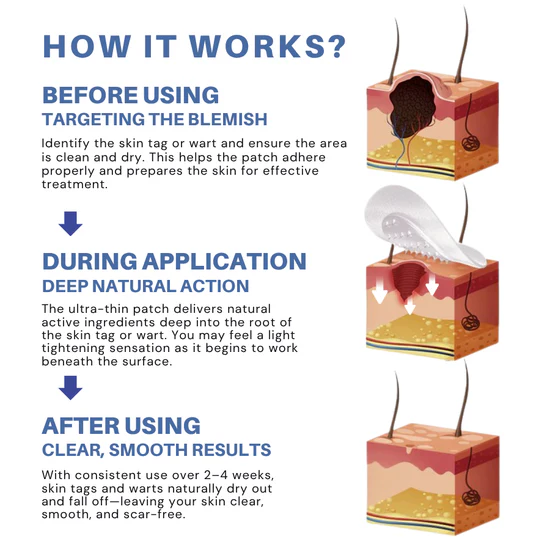 Moles & Warts Removing Skin Tag Patch - Image 2