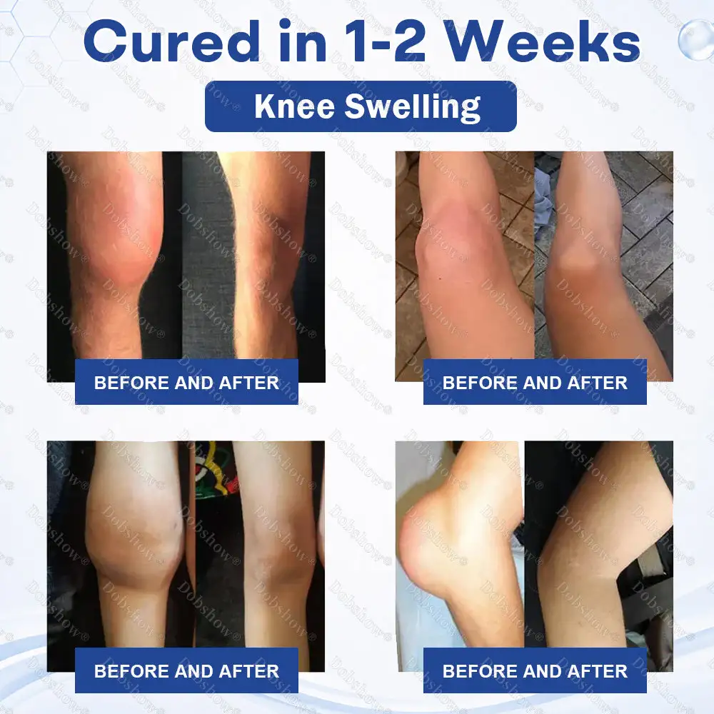 Knee Joint Pain Relief Patches - Image 3