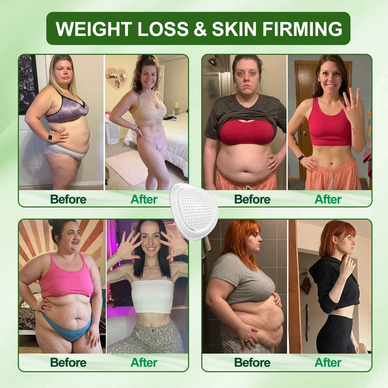 Lymphatic Drainage Slimming NanoMicroneedle Patch - Image 2