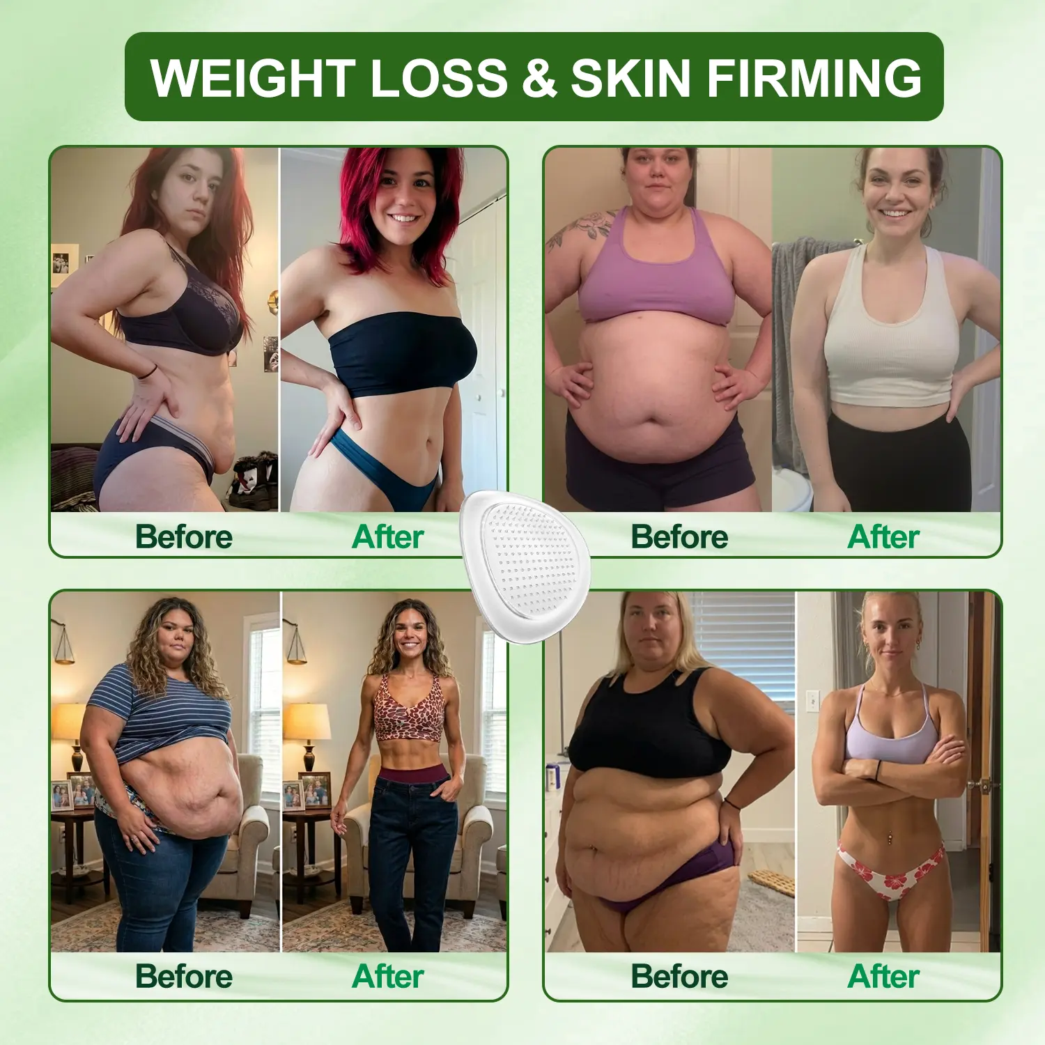 Lymphatic Drainage Slimming NanoMicroneedle Patch - Image 3