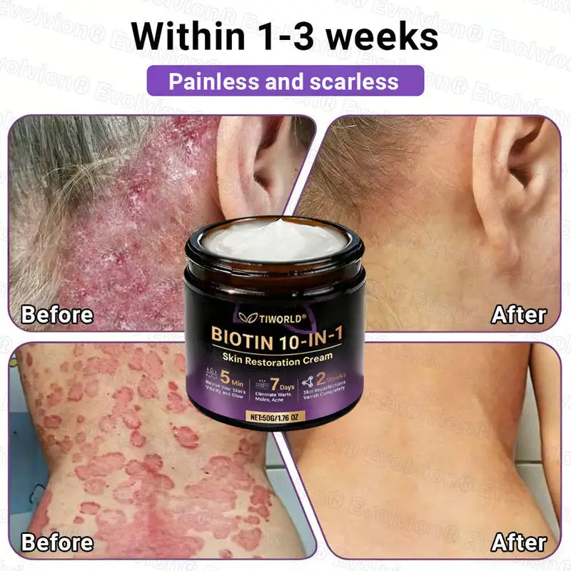 Biotin 10-in-1 Skin Restoration Cream - Image 10