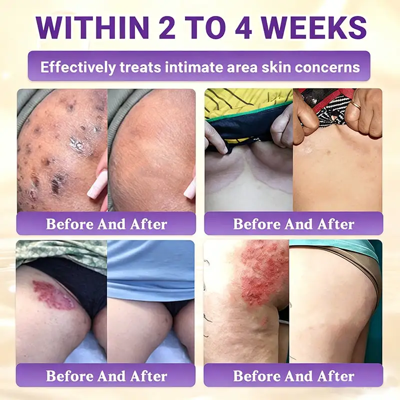 Biotin 10-in-1 Skin Restoration Cream - Image 3