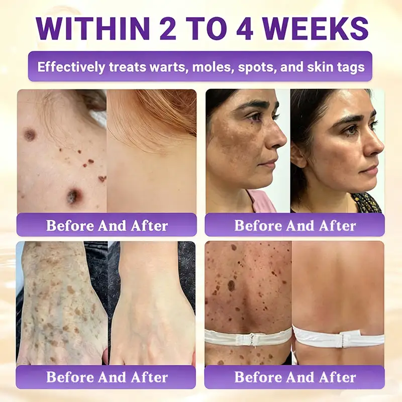 Biotin 10-in-1 Skin Restoration Cream - Image 4