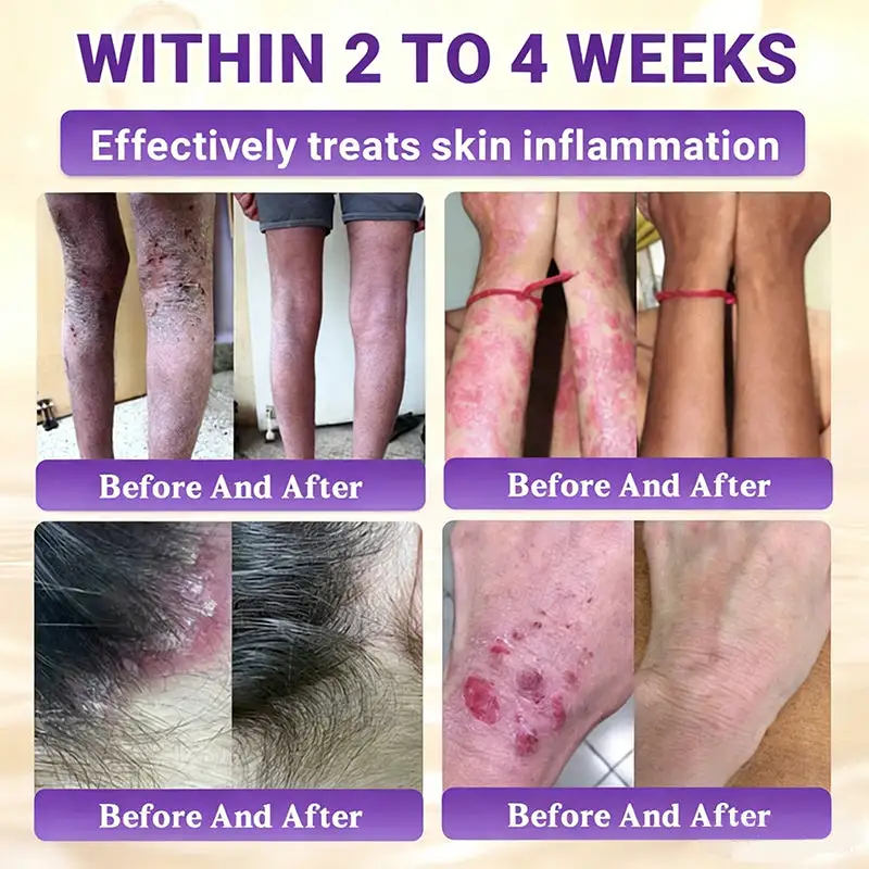 Biotin 10-in-1 Skin Restoration Cream - Image 5