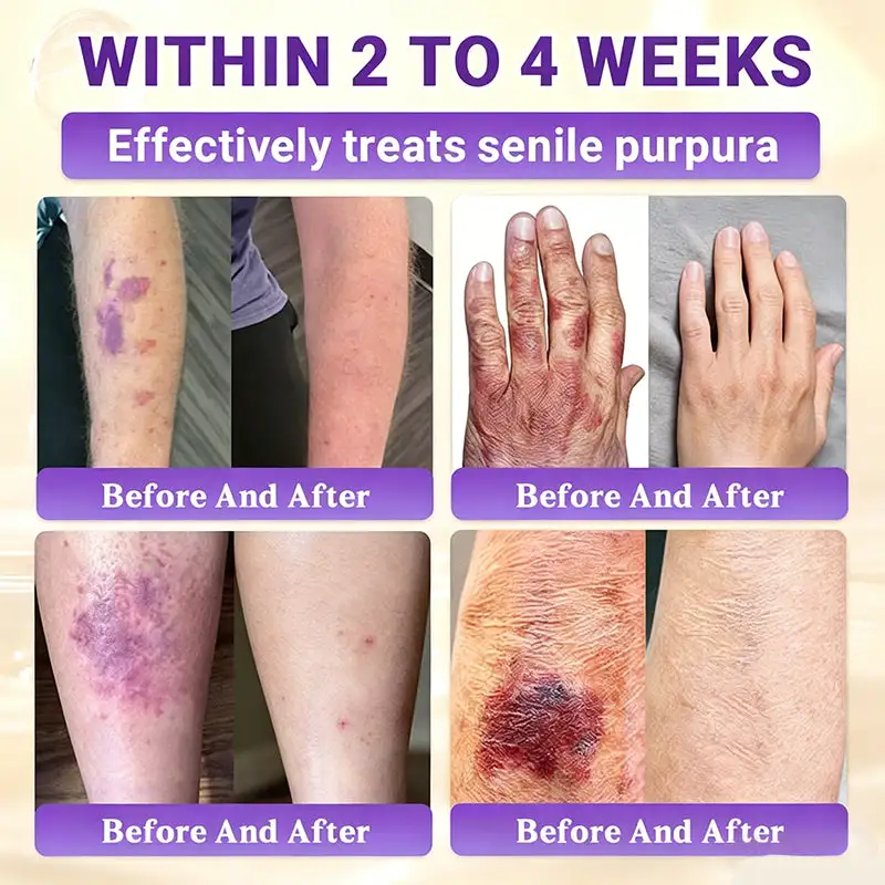 Biotin 10-in-1 Skin Restoration Cream - Image 6