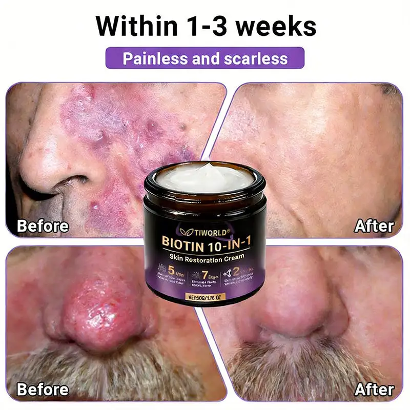 Biotin 10-in-1 Skin Restoration Cream - Image 7