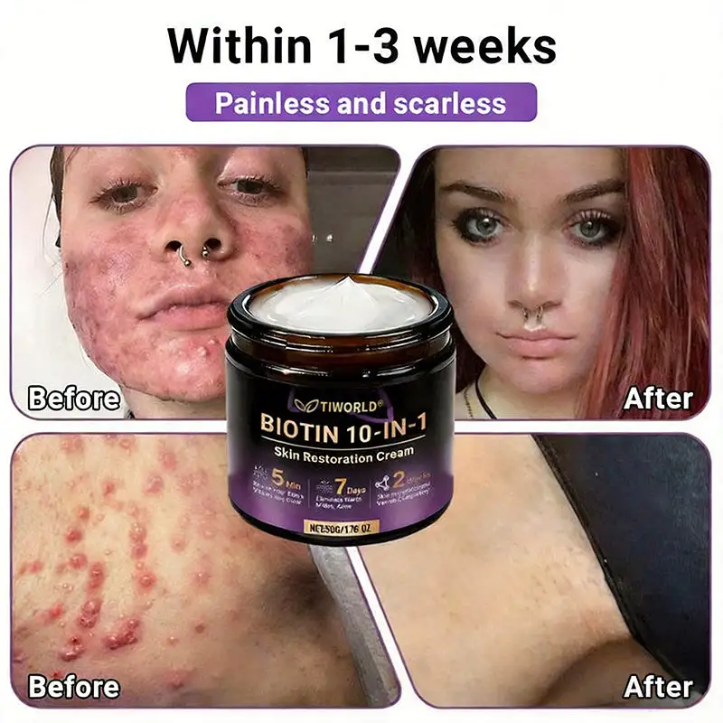 Biotin 10-in-1 Skin Restoration Cream - Image 8