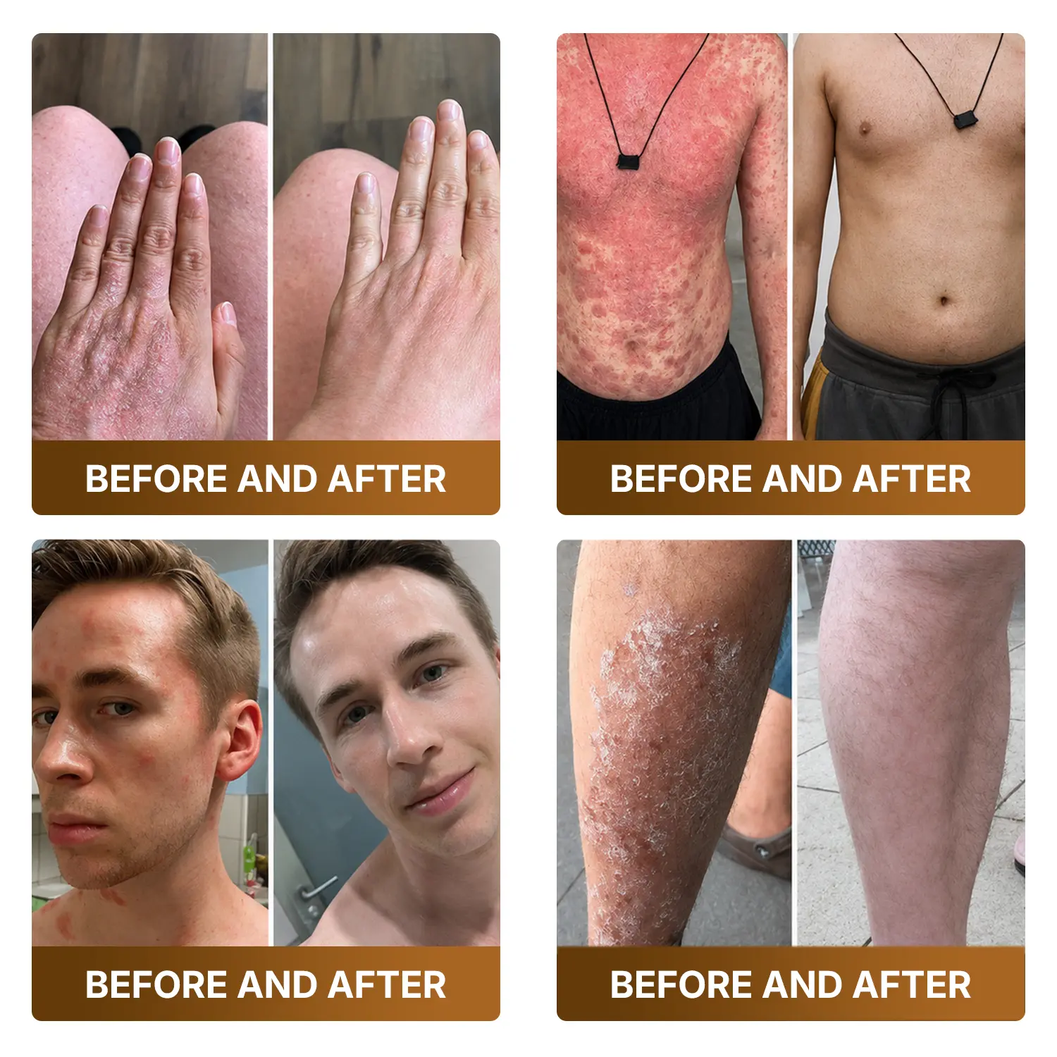 Botox & Bee Venom Advanced Recovery Cream - Image 4