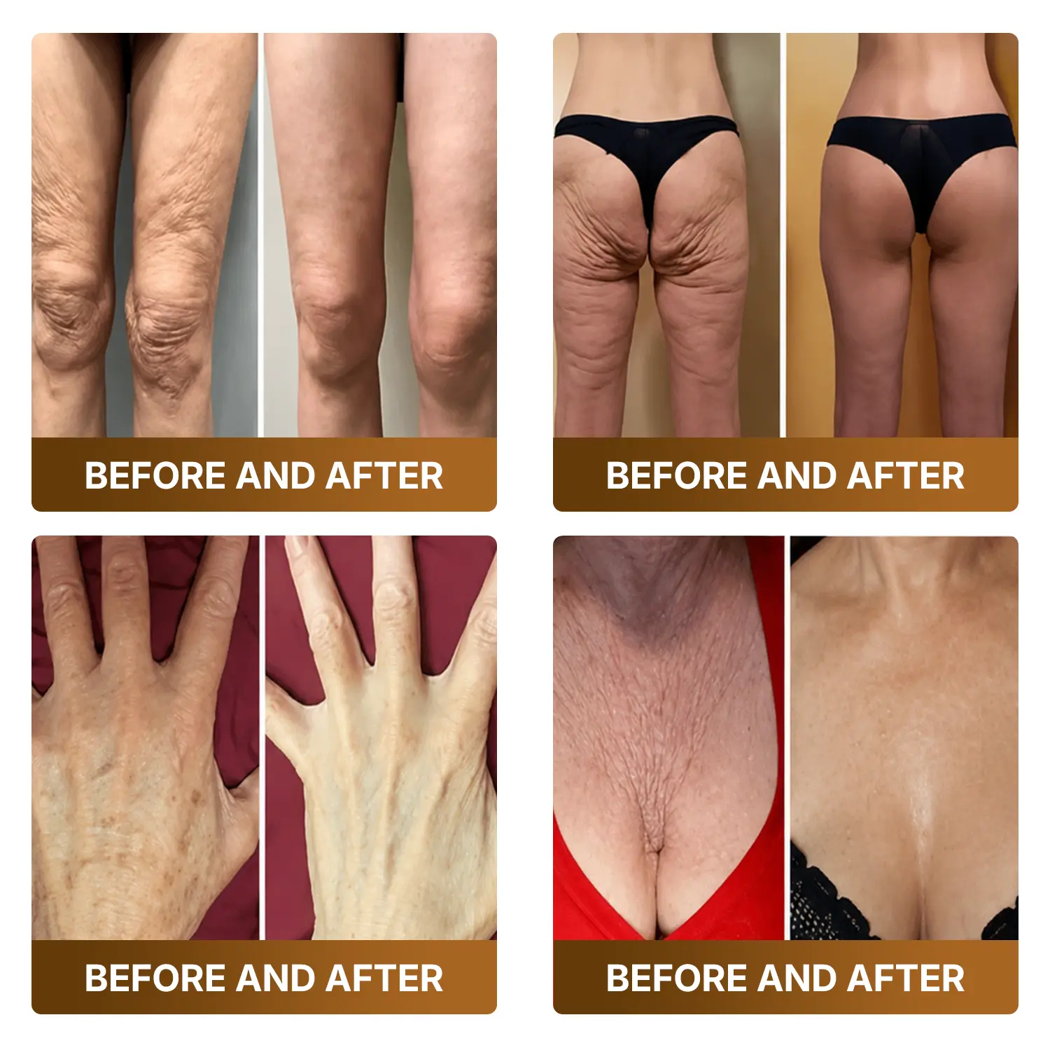 Botox & Bee Venom Advanced Recovery Cream - Image 5