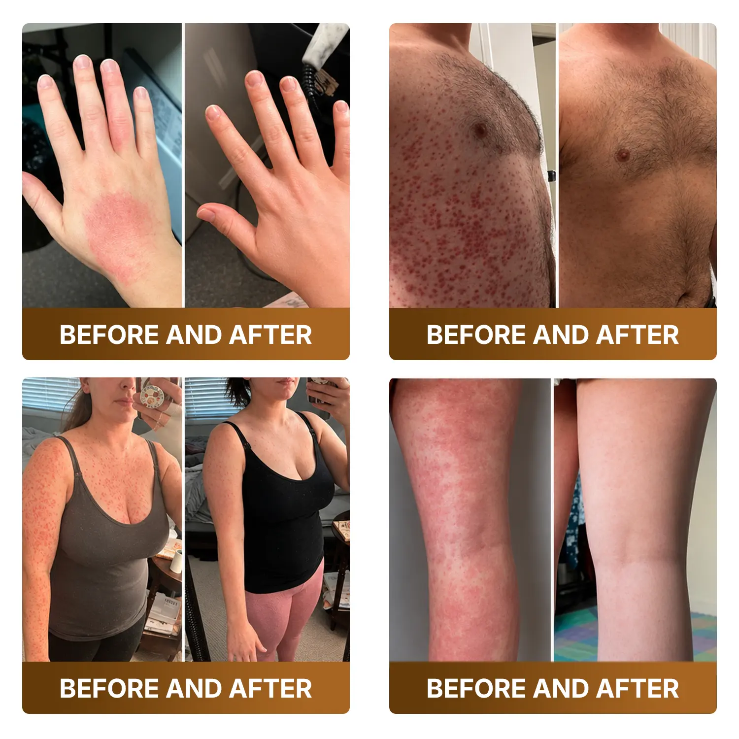 Botox & Bee Venom Advanced Recovery Cream - Image 6