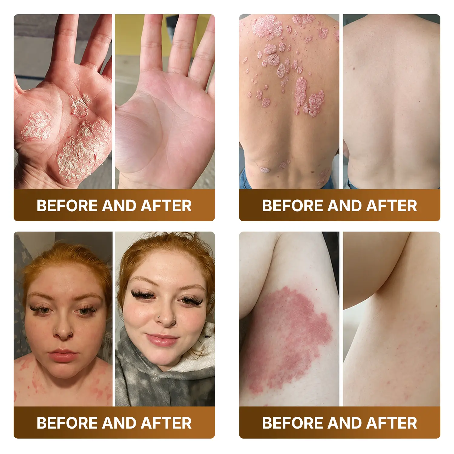 Botox & Bee Venom Advanced Recovery Cream - Image 7