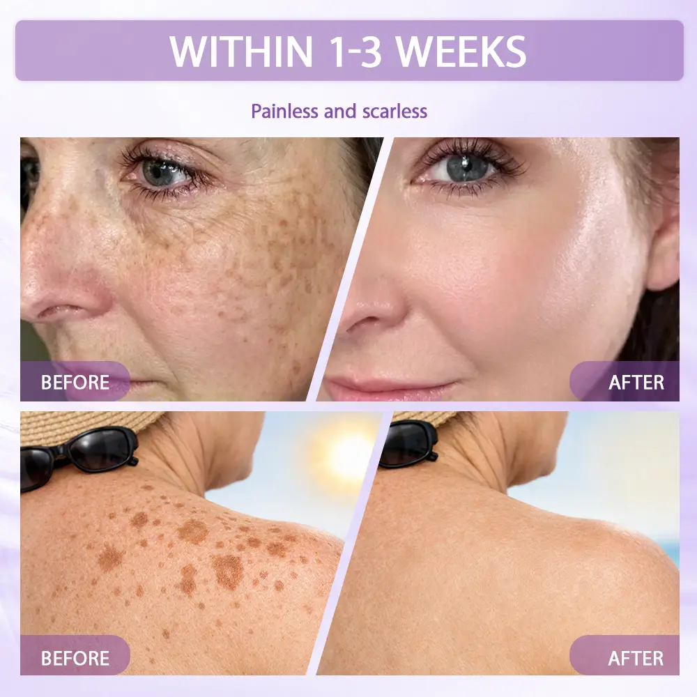 Anti-aging & Spot-repair Serum - Image 12