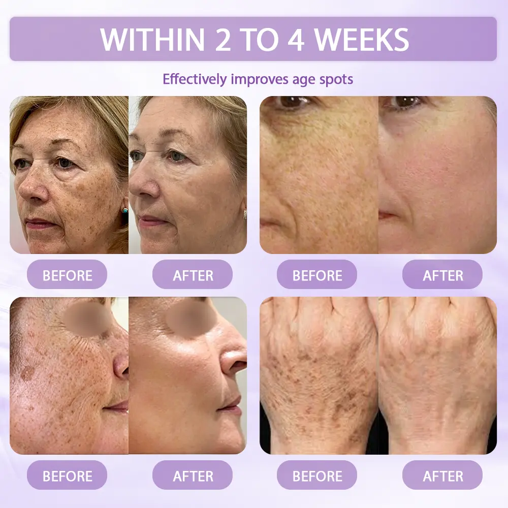 Anti-aging & Spot-repair Serum - Image 4