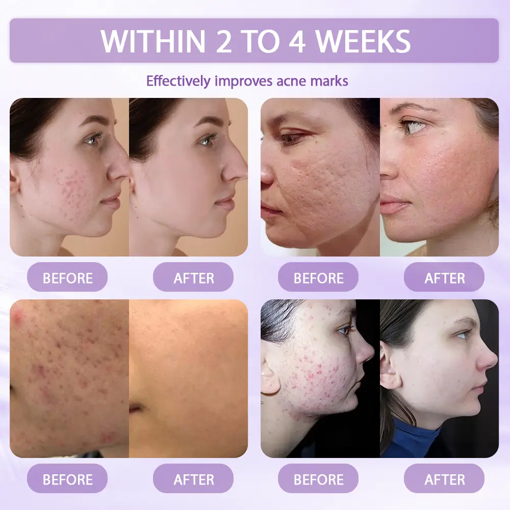Anti-aging & Spot-repair Serum - Image 5