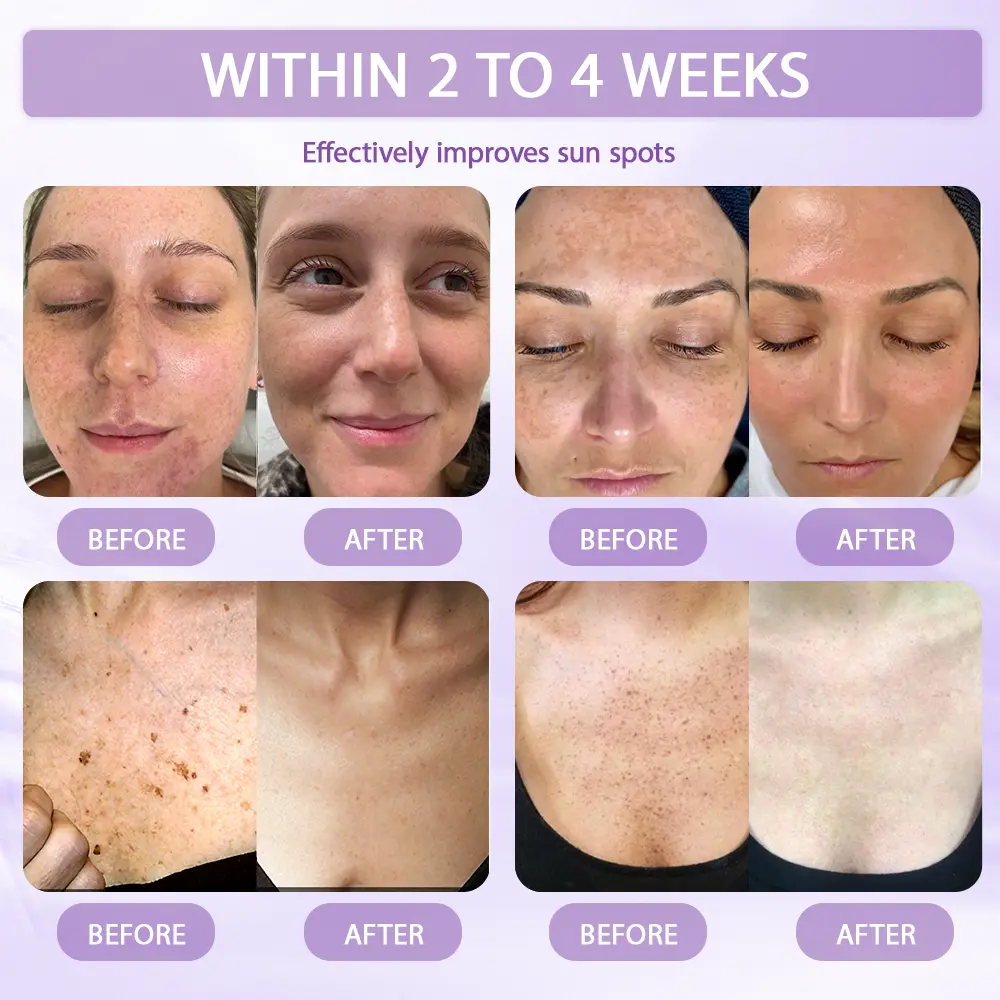 Anti-aging & Spot-repair Serum - Image 7