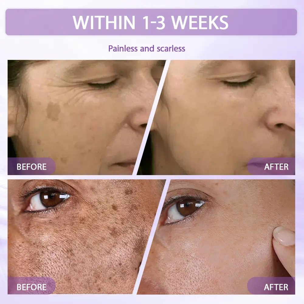 Anti-aging & Spot-repair Serum - Image 9