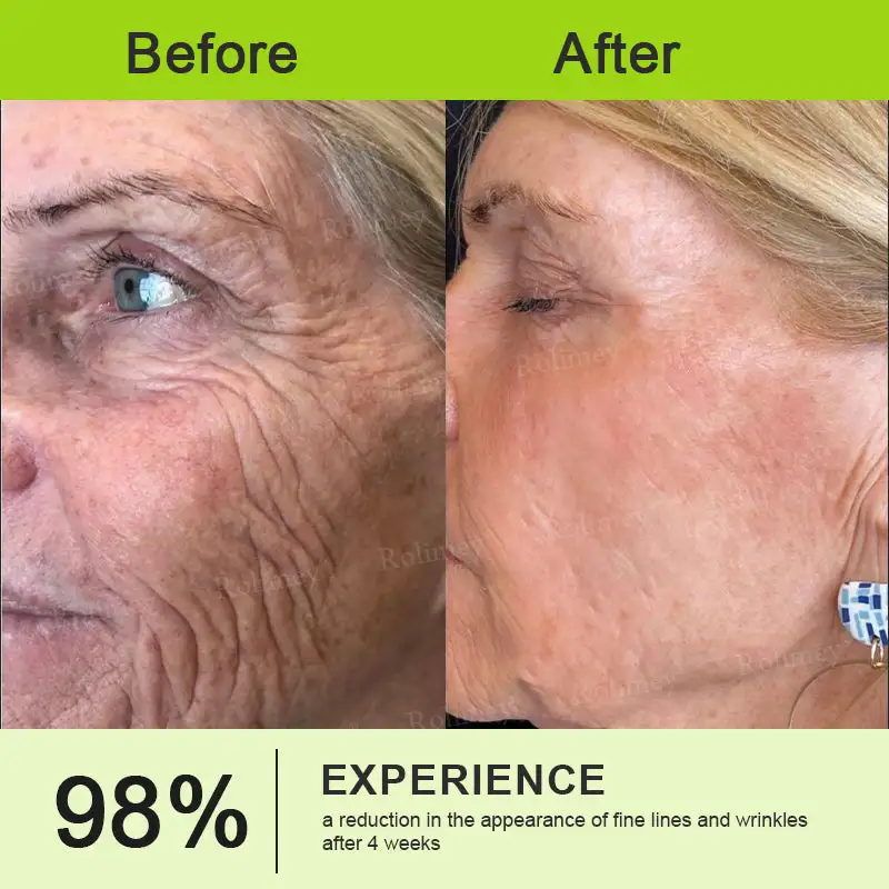 Botox & Vita-A Retinol Shot Wrinkle-Lift Tightening stick - Image 13