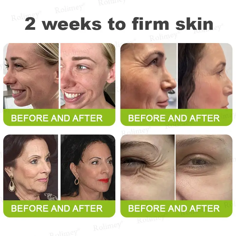 Botox & Vita-A Retinol Shot Wrinkle-Lift Tightening stick - Image 7